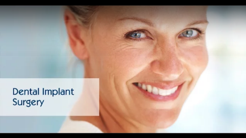 Dental Implant surgery graphic