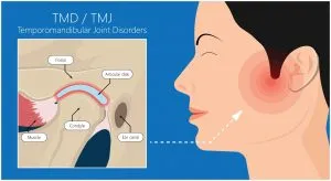 TMJ infographic